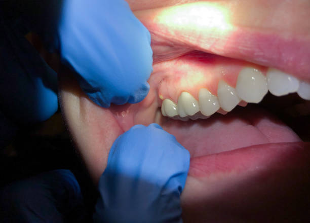  Salisbury, MO Emergency Dentist Pros
